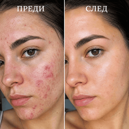 Elexy Серум за Естествено Сияние с Куркума и Витамин C